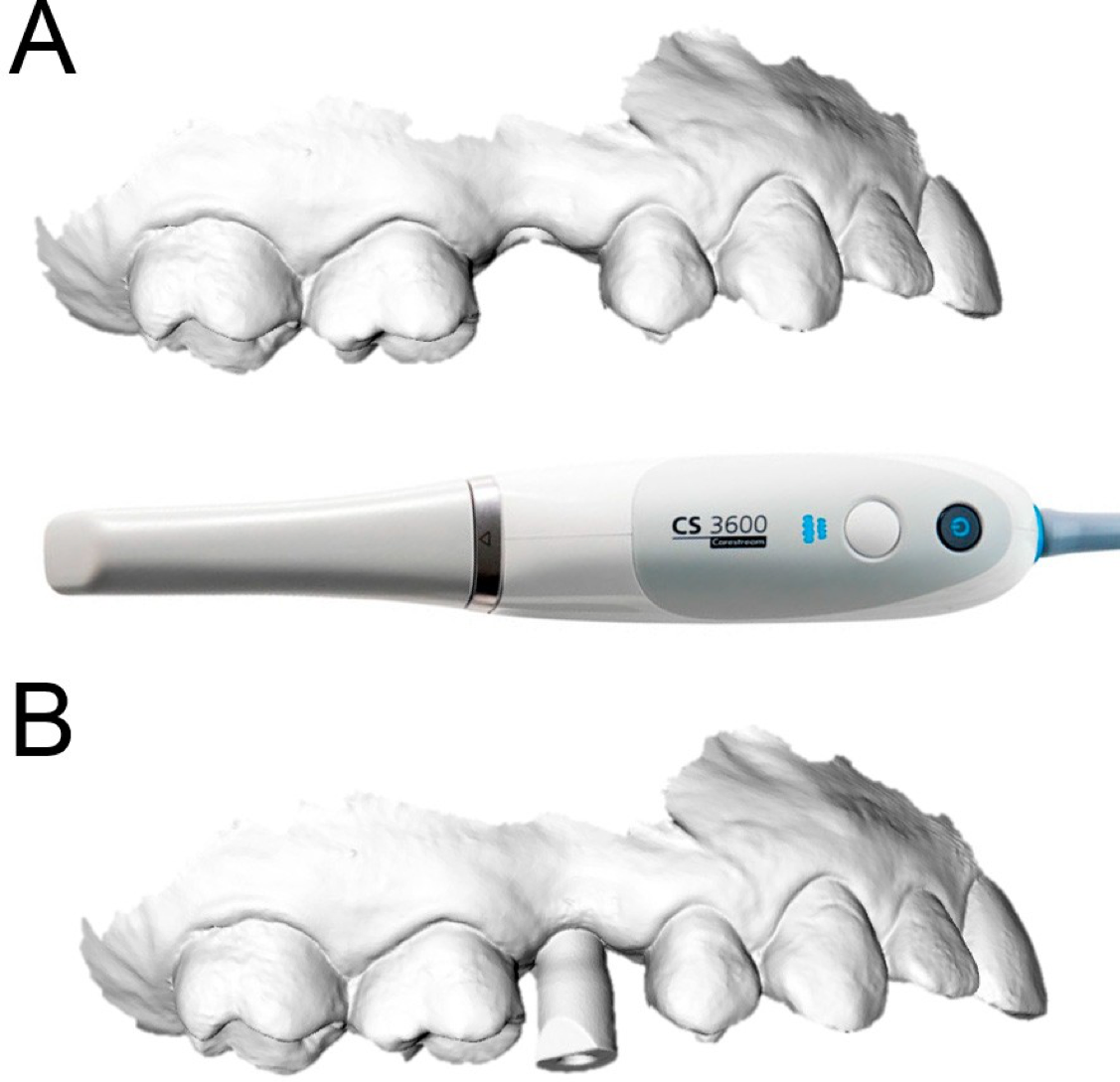 Figure11